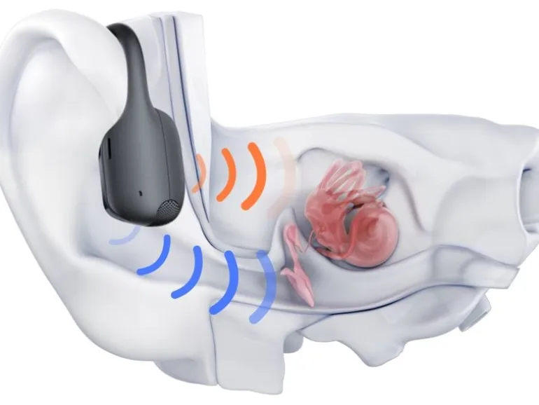 Shokz Bone Conduction Kopfhörer OpenRun Pro 2 USB-C Schwarz